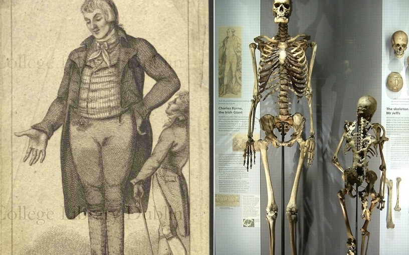 400-річний скелет німецького велетня послужить сучасній науці (фото)